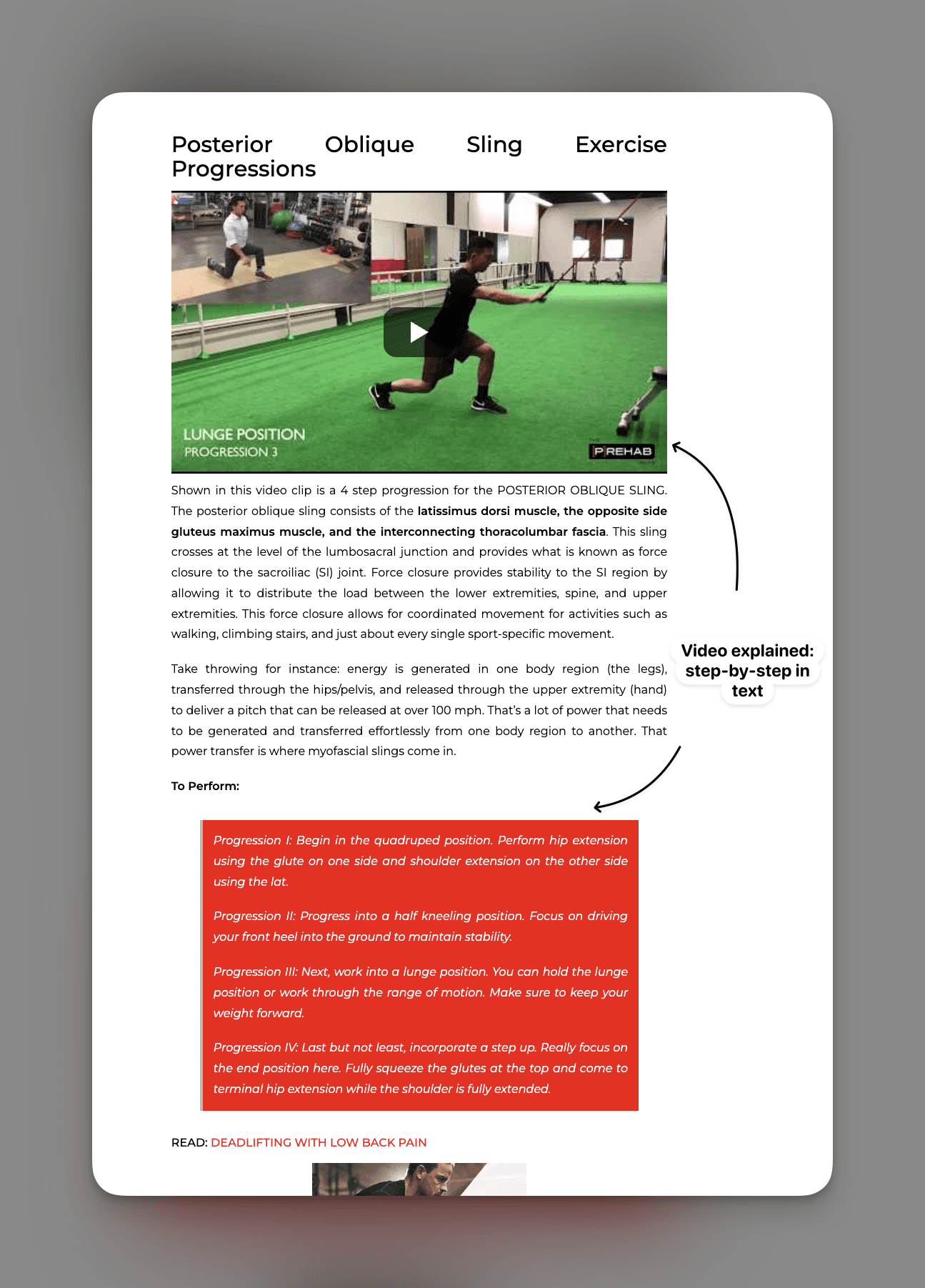 Posterior Oblique Sling progression with text callout